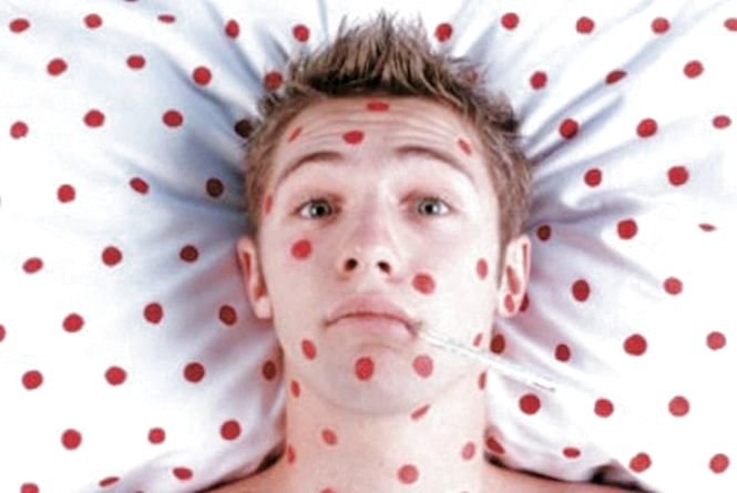 Кір не відступає — зробіть щеплення дитині до початку навчального року